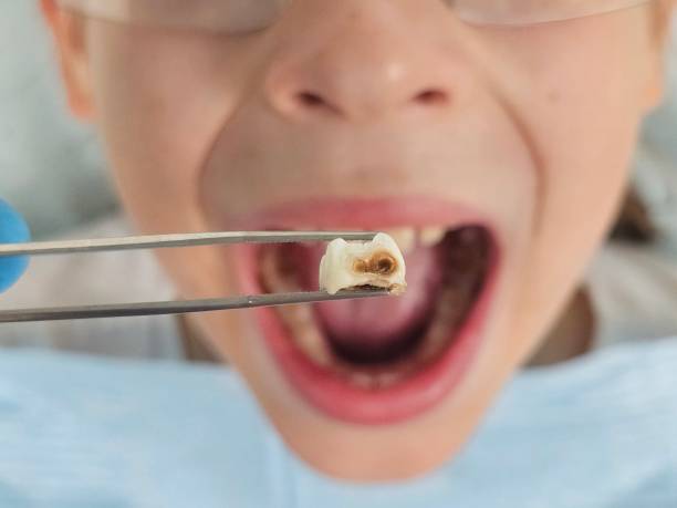 Best Emergency Dental Care for Trauma or Injury in Bellevue, NE
